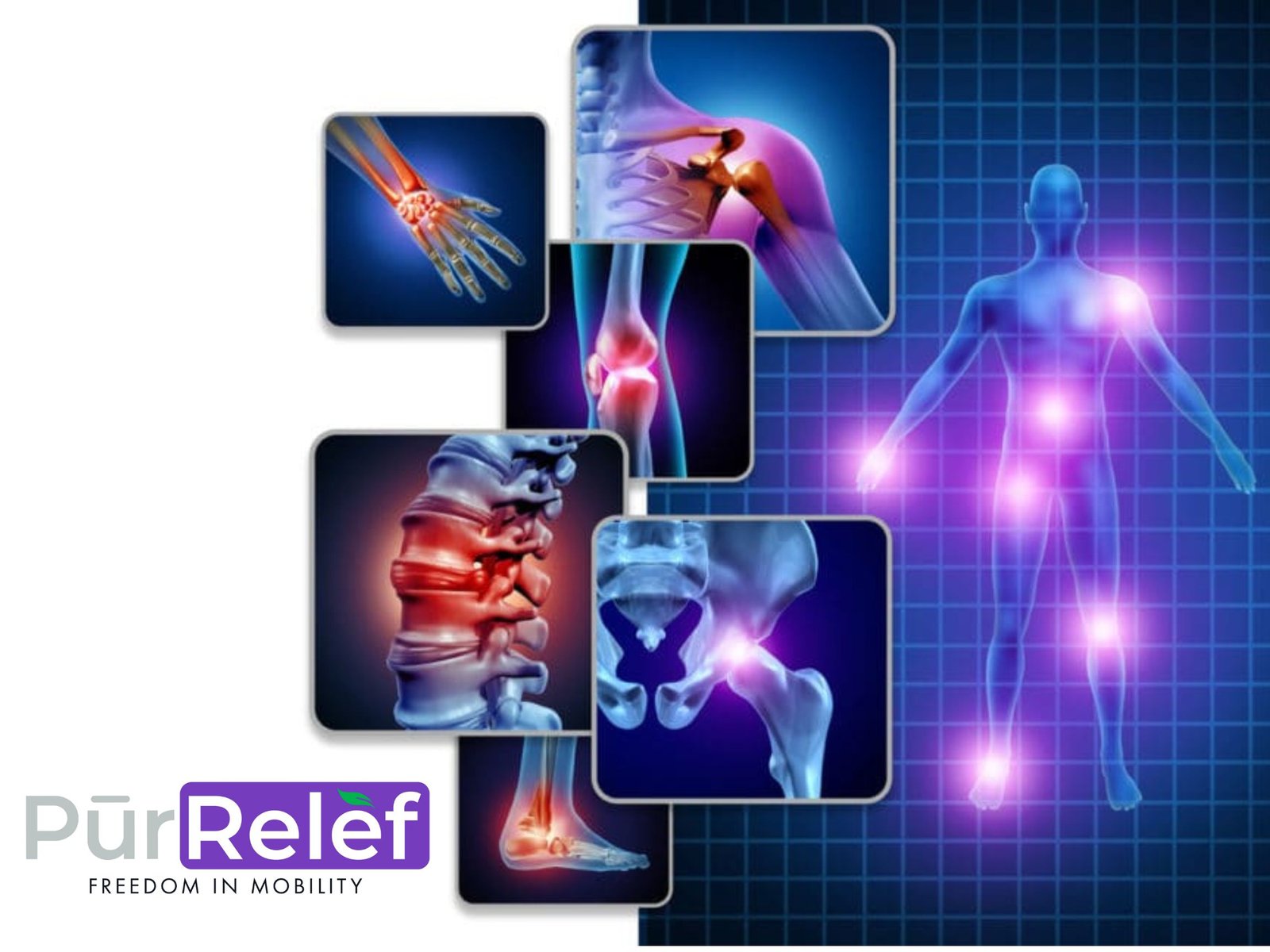 what is the best natural pain reliever for arthritis, what is the strongest natural pain reliever, natural anti-inflammatories, CBD for arthritis pain, natural arthritis relief